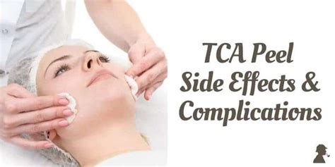 Tca Peel For Acne Scars Everything You Need To Know From Medical