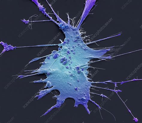 Hepatic Stellate Cell Sem Stock Image C046 0908 Science Photo Library