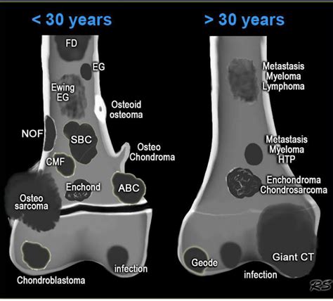 Imaging Anatomy SMS: Bone lesions diagram