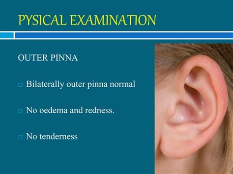 Management Of Foreign Body In Ear Ppt