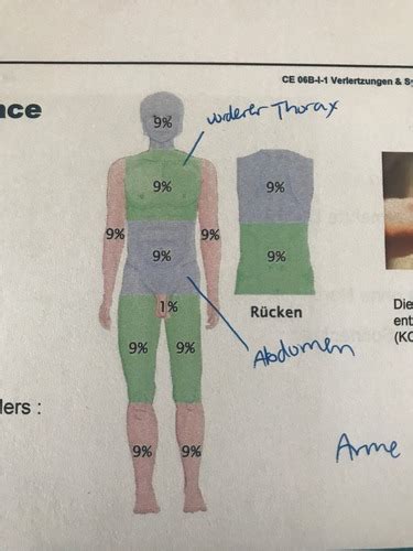 Verletzungen Symptome In Notfallsituationen Erkennen Flashcards Quizlet