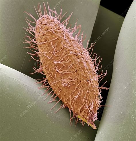 Ciliate Protozoan SEM Stock Image C015 3267 Science Photo Library