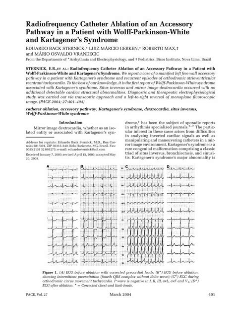 PDF Radiofrequency Catheter Ablation Of An Accessory Pathway In A