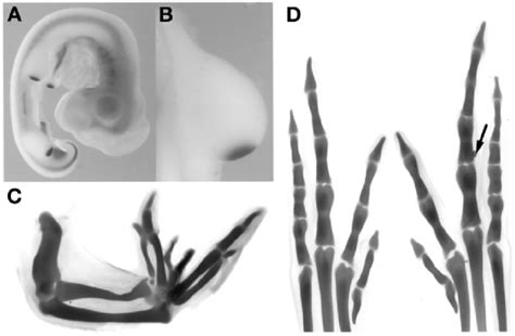 A Stage 21 Chick Embryo Showing Shh Expression In The Nervous System