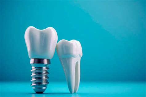 Dental Implants Procedure Benefits And Aftercare