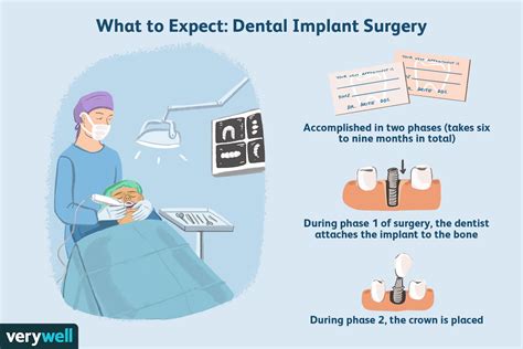 Dental Implant Procedure Preparation Recovery And Long Term Care