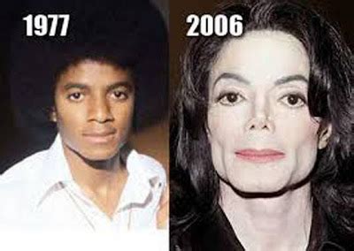 Michael Jackson Plastic Surgery Before and After Nose Jobs and Skin ...