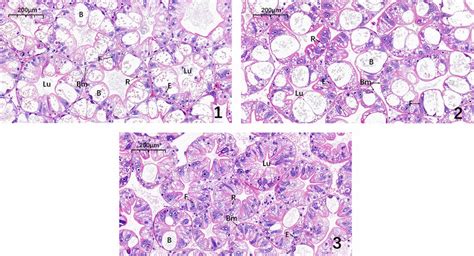 Hepatopancreas Tissue Structure Of C Destructor Grown At Different