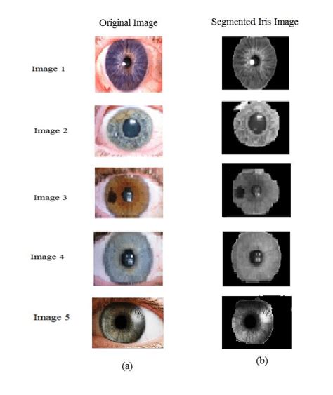 Process Of Iris Segmentation A Original Image B Segmented Iris