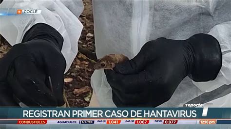 Se Registra El Primer Caso De Hantavirus En Cocl