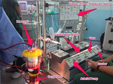 Heart Surgery Types Open Bypass Ablation Heart Valve Surgery