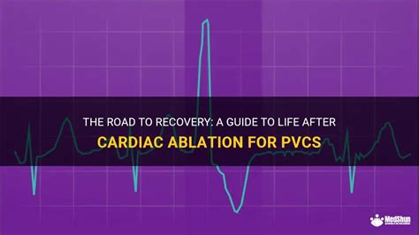 The Road To Recovery A Guide To Life After Cardiac Ablation For Pvcs Medshun