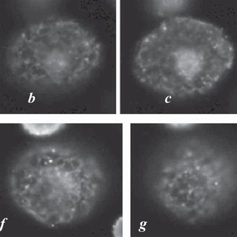 Serial Optical Sections Of A Mast Cell Treated With Anti Acth