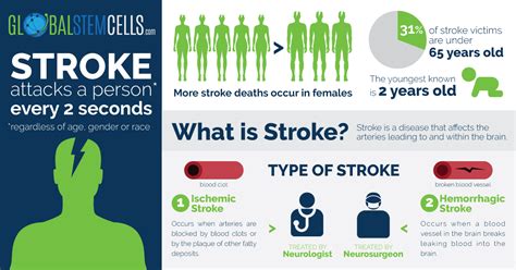 Stem Cell Treatment For Stroke Proven To Be Safe Global Stem Cells