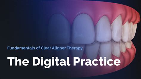 Fundamentals Of Clear Aligner Therapy The Digital Practice Invisalign Immersion