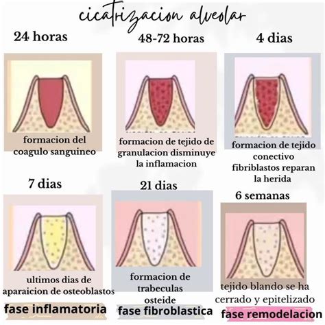 Cicatrización alveolar Elizabeth Escamilla Desiderio uDocz