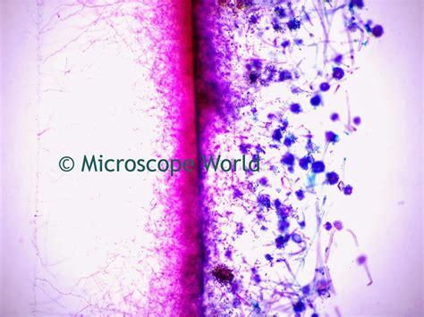 Microscope World Blog: Mold Under the Microscope