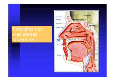 Infecção Das Vias Aereas - Cid Infecção Vias Aereas - RETOEDU