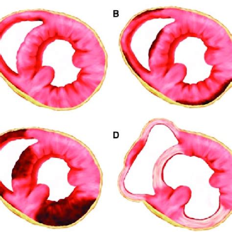 Function Of Phospholamban Pln Pln Is A Reversibly Phosphorylated