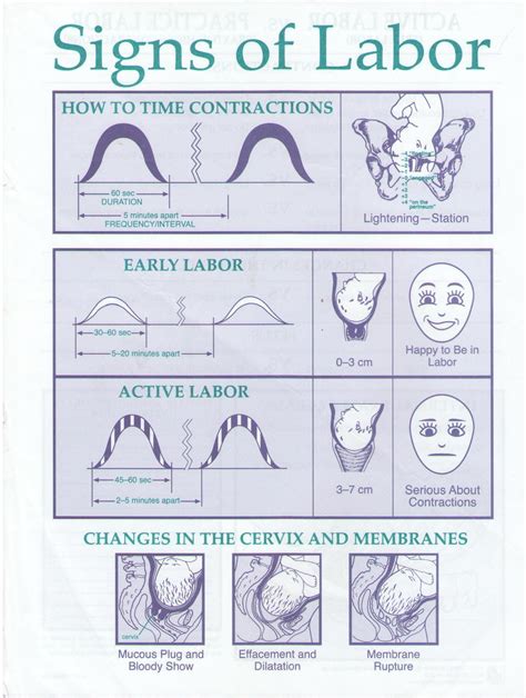 Labor Contractions Timing Chart - Remotepc.com