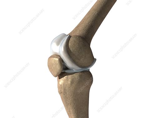 Knee bones, illustration - Stock Image - C052/3774 - Science Photo Library