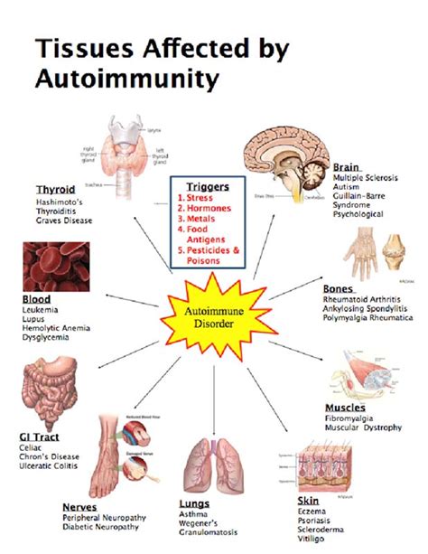 Learn and Treatment: Personal Account Autoimmune Neuropathy