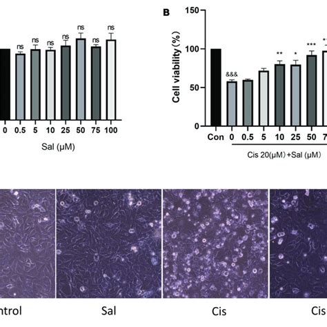 Sal Enhances The Viability Of Hei Oc Cells After Cisplatin Damage