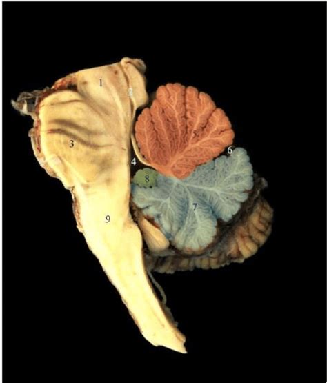 Midsagittal Section Showing The Arbor Vitae Note Midbrain