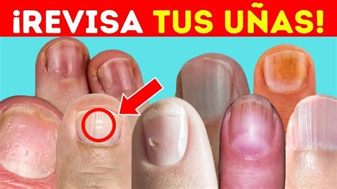 9 señales IMPORTANTES que tus uñas pueden revelar sobre tu salud YouTube