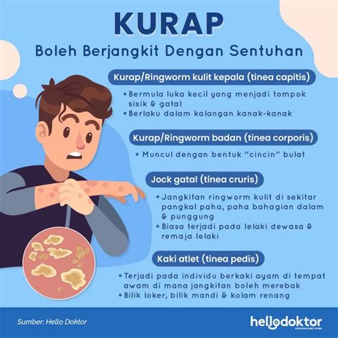 Celah Peha Ubat Gatal Celah Kelangkang Di Farmasi Ozpure Eczema Cream