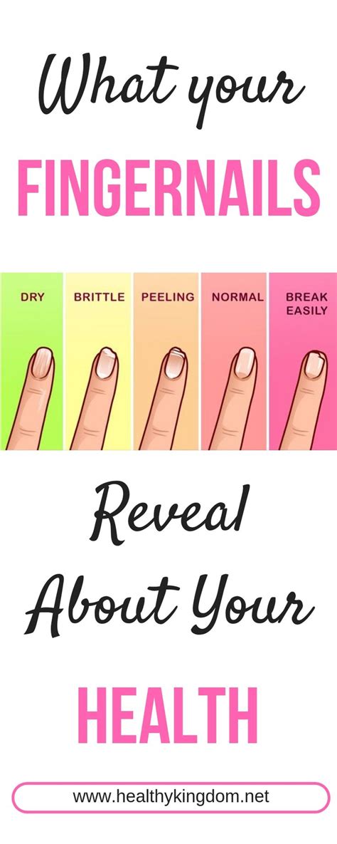 What Your Fingernails Reveal About Your Health Healthy Kingdom