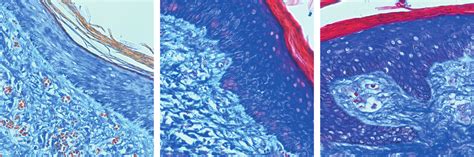 Differentiated epithelium in the area of full-thickness wounds at week... | Download Scientific ...