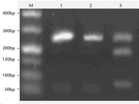 Scielo Brasil Correlation Between Gdf 15 Gene Polymorphism And The Formation Of Collateral