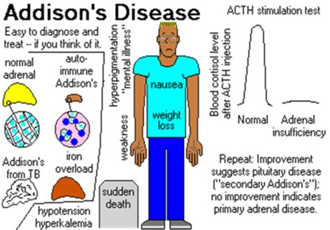 Addison S And Cushing S Flashcards Quizlet
