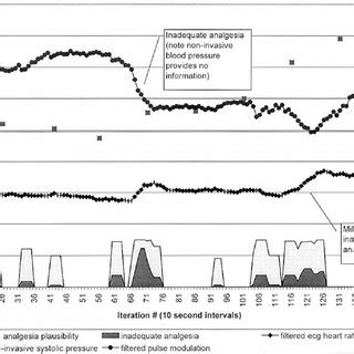 Diagnosis of malignant hyperpyrexia. | Download Scientific Diagram