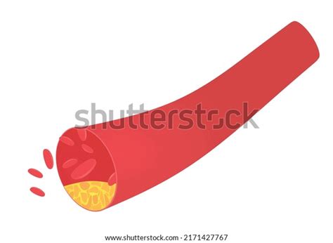 Vektor Stok Vascular Blood Artery Vector Illustration Tanpa Royalti