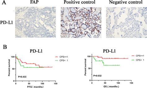 The Prognostic And Clinicopathological Roles Of Microsatellite