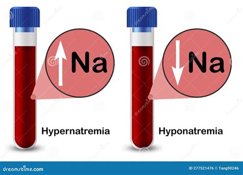 Hypernatremia And Hyponatremia With Blood Shape Royalty Free Stock