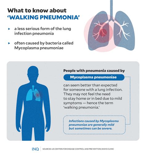 News About Walking Pneumonia 2024 Usa - Maire Roxanne