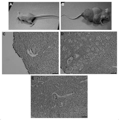 Teratoma Formation Assay For PFGSCs Injected Into Nude Mice A No