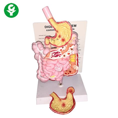 Human Digestive System Model Common Pathologies Anatomical Kg Weight