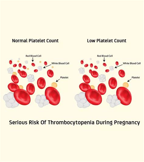 What Causes Skin Rashes During Pregnancy