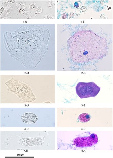 Various Cells 400 U Unstained S Sternheimer Stain 1 U Active