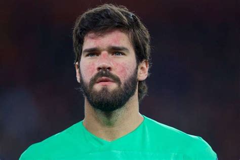 Entenda a vermelhidão no rosto do goleiro Alisson Becker