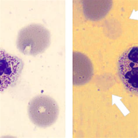 Ghost Cells As A Result Of The Clostridium Perfringens Alpha Toxin In