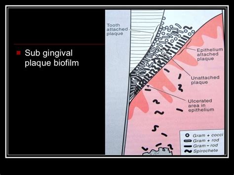 Dental Plaque