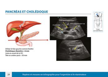 Repères et mesures en échographie pour l urgentiste et le réanimateur