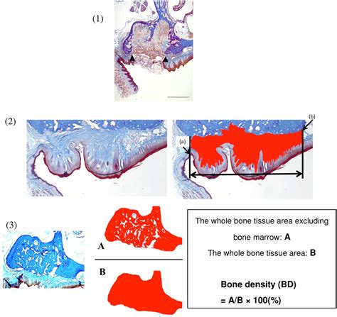 (1) Epithelial wound healing was defined as the distance between both... | Download Scientific ...