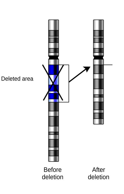 Deletion (genetics) - Wikipedia