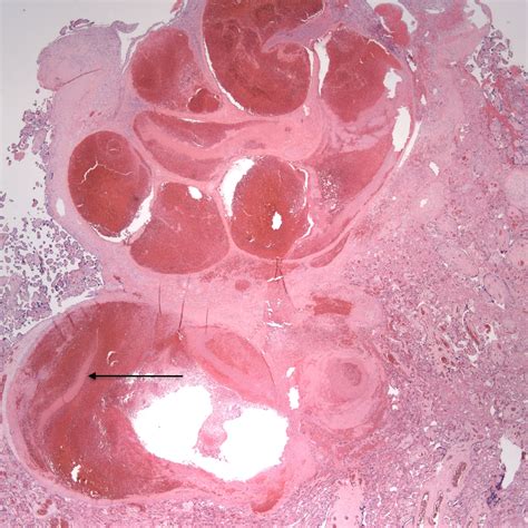 Chapter Placental Perfusion Section A Spiral Arteries Obstetrical